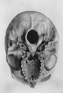Skull viewed from below