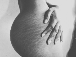 baeg0d:  thepatwa:  ASS SO FAT makes your skin CRACK  SO SEXY….  stretch marks &lt;3  😻 