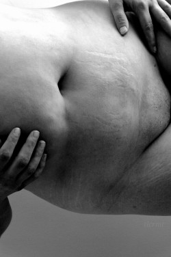 tlcrmtphotography:  Tummy series IV Stretch marks and scars B/W alternative edit Shot and edited by T (me)   Belleza natural