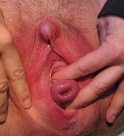 pussymodsgaloreWell stretched, well used pussy with prolapsed uterus. To put it bluntly, if you stretch your pussy wide enough, the innards are likely to fall out! Large clit just begging for a nice piercing!