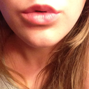 Lipstick and Valtrex