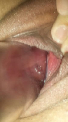 prolapsingpussy:  Penis pump sucking my wife’s cervix out to play. Follow us @stretchedcouple for more pixs and vids!  you did great progress! Would love to see her cervix prolapsing out of her gaping pussy  Amazing - more of this activity please