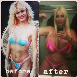 laceywildd:  My before and after. In before pic I had already had my first book job at 23 yes old. From a A A to a LLL. Iâ€™m 3500 cc each break thatâ€™s 7000 cc in all.#plasticlife #barbienation #blondenation #plastic #Botched #eonline #realitytv #celebr