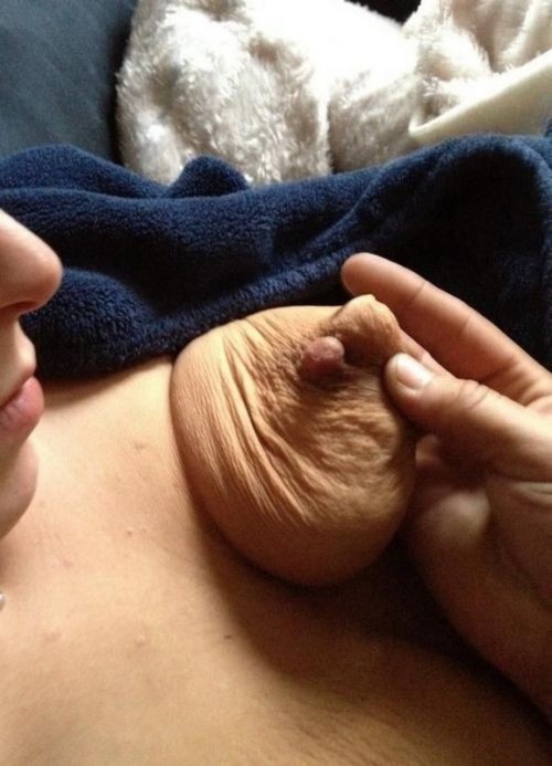 Puffy stretch marks tits
