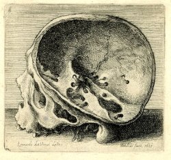 blackpaint20:  Skull in profile to left with the left side of the cranium removed and holes with worms inside and below, after Leonardo da Vinci. 1651 Etching Print made by Wenceslaus Hollar after Leonardo da Vinci  1651