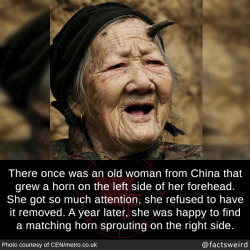 mindblowingfactz:  There once was an old woman from China that grew a horn on the left side of her forehead. She got so much attention, she refused to have it removed. A year later, she was happy to find a matching horn sprouting on the right side.