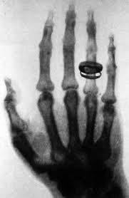 orexi:ten-and-donna:dj-froge:sixpenceee:First Human X-ray 1896. The woman, Marie Curie, who took part in this experiment had so many X-rays taken that she developed a form of blood cancer and died.Took part? TOOK PART????? SHE FUCKIN INVENTED THAT SHIT