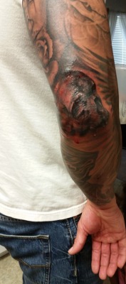 Got my elbow filled, need to post it when it&rsquo;s healed
