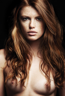 sexylabiadotnet:  redheadspassion:  If you like what you see go to Redheads Passion  Freckles! ♡♡ 