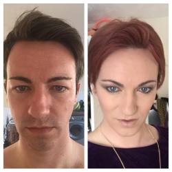 leicester-sissy:  HRT day 1 and Month 9 time just goes so fast. Loving my transition it’s been so special. Something I’ve only dreamed of has become a reality. #transexual #transgirl #transgender #mtf #transitioning #transisbeautiful #teamtrans #hrt