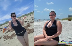emilieaudrey:  ahandfullofyou:  emilieaudrey:  I wanted to share a photo to show the difference one year can make. Left: Me in June 2012 Right: Me in June 2013 A couple of years ago, I was really healthy for the first time in my life.  I was in a longer