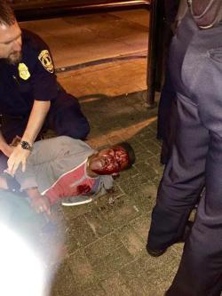 jessehimself:On Tuesday night, a third-year student at the University of Virginia named Martese Johnson was thrown to the ground by police officers and beaten bloody in public on the main social drag of campus—all apparently because he tried to use