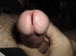gaping-peeholes:my naturally large piss slit
