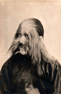 Homme atteint d'hypertrichose (pilosité envahissante sur une partie du corps ou sa totalité, aussi appelée &ldquo;syndrome du loup-garou&rdquo;), Japon,1890.