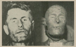 The bizarre story of Elmer McCurdy - mummified in 1911, found painted neon orange and hanging in an amusement park in 1976.  http://thehumanmarvels.com/888/elmer-mccurdy-the-wandering-dead/disfigured