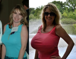 boobgrowth:  The gorgeous Nancy Quill, before and after her breast augmentation.Â Nancy didnâ€™t have small tits to begin with, but decided to get absolutely massive implants. Her current size is unknown.â€“Keep the boobies growing! Support Boob Growth
