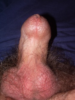 blindmeat:  I love this cock.  Totally unretractable foreskin, tiny hole in the foresking, short, taut shaft skin, small cock, wild bush.  I’m in love. 