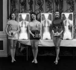 did-you-kno:   sixpenceee: Miss Correct Posture (1956). In the 50’s and 60s’, American chiropractors held a series of rather unusual beauty pageants where contestants were judged and winners picked not only by their apparent beauty and poise, but