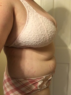 donuuuuuts:  A before and after of my water bloat (yes it’s me I’m back I missed all you belly lovers)