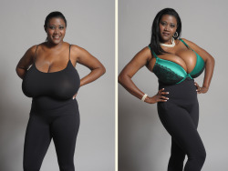funbaggery:  funbaggery:  Kerisha 36NNN breasts (reduced). Woman with the largest known natural breasts in Texas had 10 pounds removed from each. The top photo she’s pictured bra-less and in a 36NNN custom harness obviously too small for her.  Attention