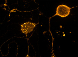 neurosciencestuff:  (Image caption: After treatment with the DAMGO, an endogenous mu-opiod  receptor is internalized in endosomes (above, left) and after DAMGO  washout is recycled back to the cell surface (above, right))Researchers Discover How Pain