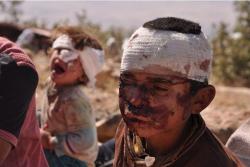 pine-dalecki:  w-jin:  buscadoradevida:  kchikurdi:  this is what ISIS has been doing to the yezidi children. what they do to their women is even worse. please don’t keep yourself ignorant about what’s happening to the (yezidi) kurds.  just back to