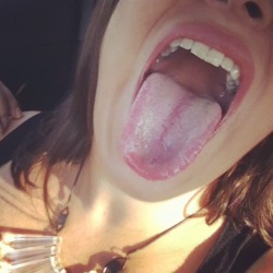 clubpeachfeet:  #mouthfetish #tonguefetish #lips #teeth #straightteeth #openwide #spit #spitfetish #swallow