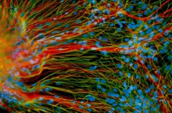 currentsinbiology:  Derived from human embryonic stem cells, precursor neural cells grow in a lab dish and generate mature neurons (red) and glial cells (green), in the lab of University of Wisconsin-Madison stem cell researcher and neurodevelopmental