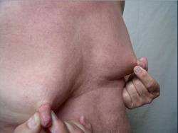 Male nipples