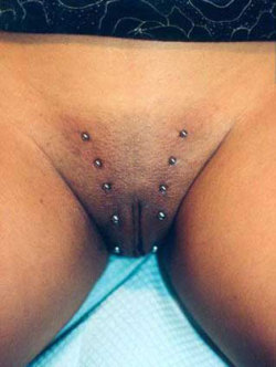 Dermals, studs implanted into the skin.