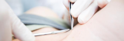   Dealing with Skin Tags on your Neckhttp://www.cliffys.com.au/removal-guide/skin-tags-on-the-neck/