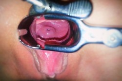 dysfunctional-amateurs:  dysfunctional-amateurs:  No fear, Doctor Aaron is here. Â Lydia brought home a nice tool for me to add to my collectionâ€žâ€ž so I thought I should check out her cervix for her. Real couple, come follow us. Â I take lotâ€™s of