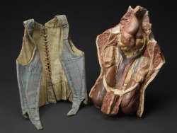 Plaster model showing internal organs displaced due to tight corseting, Europe, 1901-1925