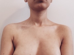 gurkeyrith:  I hated my body. I hated all the hair. All the stretch marks. All the discoloured spots. All the curves. All the edges. All of it. Every atom of it. I hated me.I would lie in bed every night reimagining my body but without the stretch marks