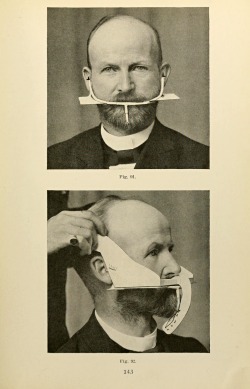 Prosthetic Dentistry, 1914.