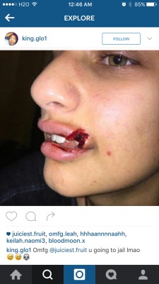 realdowntomarsgirll:  verylilpimpin:  lovelylarayyy:  This is the aftermath of the “ who you calling a Nigga” girl punching the white girl 😩😩😩😩😩😩   DAM  But I mean since you wanna talk shit you don’t really need that lip.