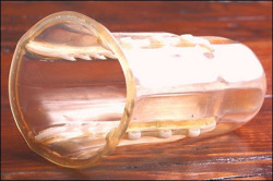 itslealove:  fuckyeschristina:  jawsdroppinjinny:  kimmieegee:  aysiamalaysia:  thecomicbookcrushkid:  conorbennett:   An anti-rape female condom invented by Sonette Ehlers… A South African women working as a blood technician with the South African