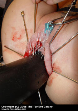 pussymodsgaloreBDSM pain games. Large plastic (?) object pushed into her pussy and held there by heavy gauge needles driven through her outer labia, additional needle play with smaller needles.