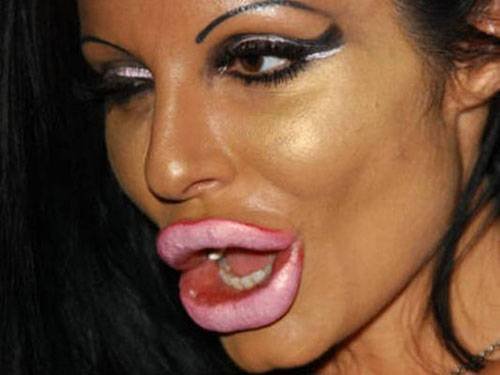 Big lips plastic surgery gone wrong long sex pictures