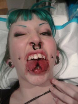 tentaclesandteacups:  Having your tongue split is about as fun as it looks as well.The black things are sutures, and yes, it all sucked quite equally. WORTH IT!  I love this. 