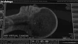 twi-blast:  xwhatserface:  This is a person dying under an MRI scan some doctors don’t know what the fuck they’re doing and shoot their patients tragically beautiful.  How many times am I going to have to point out that this clip is from the Walking