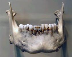 slimdontactright:  sapphrikah:  distant-relatives-blog:  The earliest evidence of ancient dentistry we have is an amazingly detailed dental work on a mummy from ancient Egypt that archaeologists have dated to 2000 BCE. The work shows intricate gold work