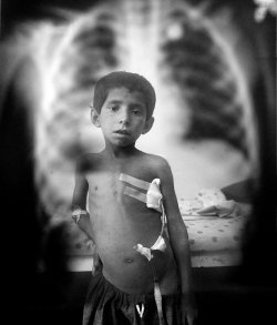 warwithinaframe:  Attiullah,7, is seen posing in front of an x-ray of the bullet that entered the small boy’s back coming out through his chest standing by his bed at Mirwais hospital October 13, 2009 Kandahar, Afghanistan. According to his grandfather,