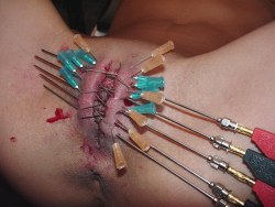 pussymodsgaloreBDSM pain games, pussy torture and needle play. Five large needles are pushed through her outer labia horizontally, followed by numerous smaller needles.