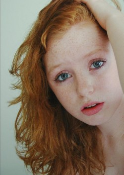 Blue eyes and freckles.