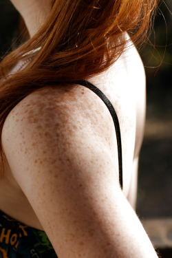 Sexy freckles.