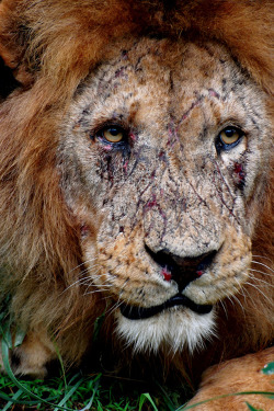 gabbyroars:  inlovewiththelies:  stfuchelc:  brookelife:  mmarinaye:  adeelbadeel:  erraticintrovert:  Battlescars.  The face of a true King  so fucking raw  Fuck those pretty high def pictures. This that real shit.  this makes me want to cry   Wow  Lmao