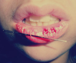 jabbyparatuwebeo:  Holi no soy la niña perfecta con dientes perfectos :(( pero tengo una aguja en el labio lml slkjkldfg 