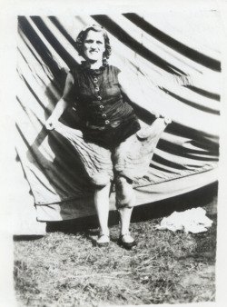 Melle Agnès C. Schmidt la femme à la peau caoutchouc dont la peau des hanches pendait sur les genoux.